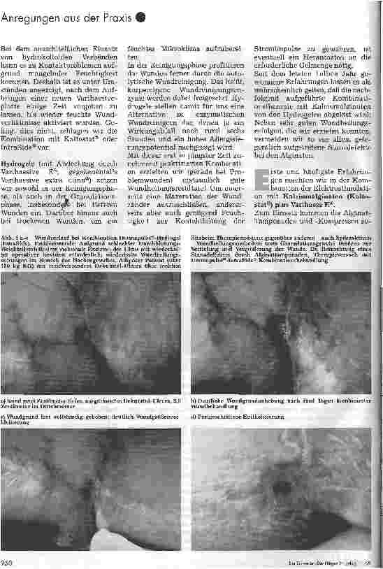 Vorschauseite 4: Kombination der Dermapulse-Behandlung mit hydroaktiven Verbänden Ein Erfahrungsbericht über eine modifizierte Wundbehandlungsmethode bei Dekubital-Ulcera