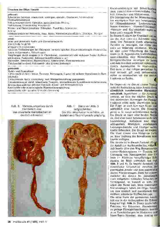 Vorschauseite 2: Anurie - postrenale Ursachen, Diagnostik und Therapie