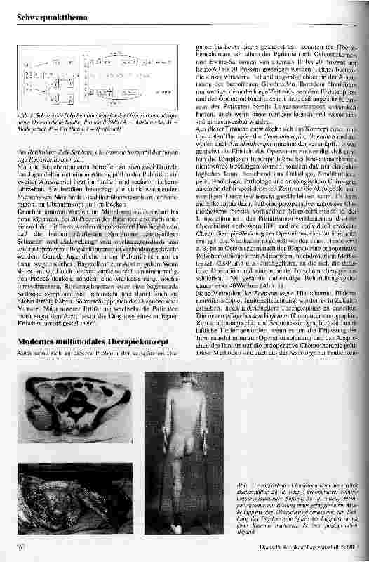 Vorschauseite 2: Die chirurgische Therapie bösartiger Knochentumoren