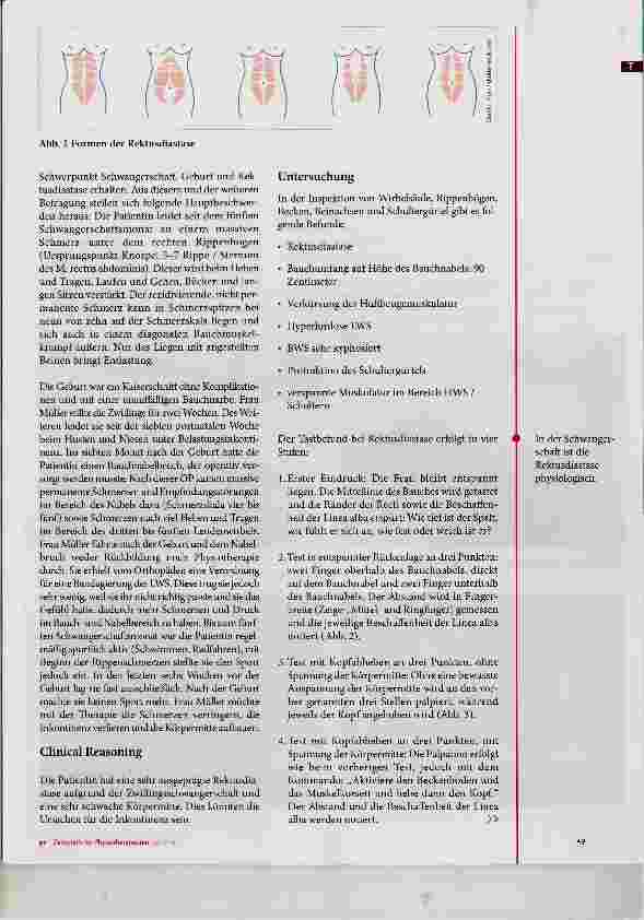 Vorschauseite 2: Rektusdiastase nach der Schwangerschaft