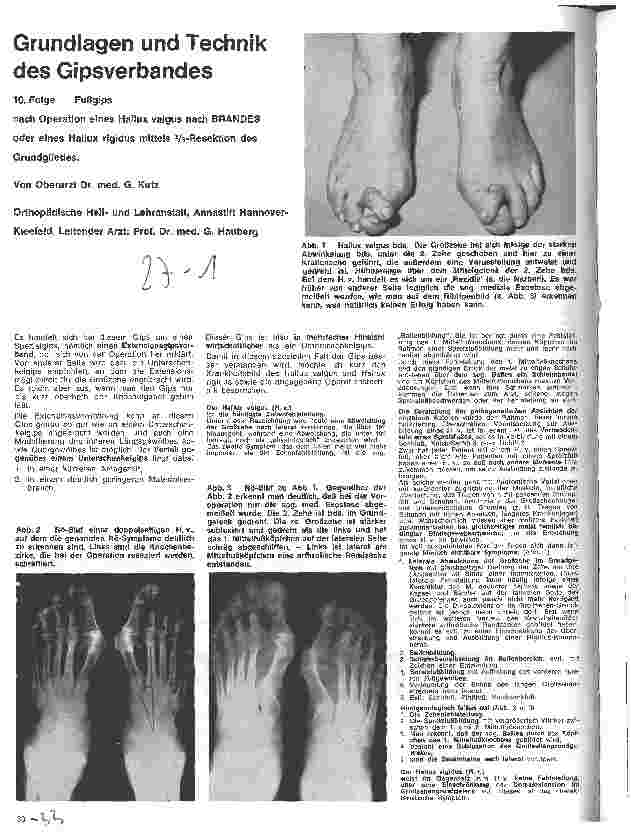 Vorschauseite 1: Grundlagen und Technik des Gipsverbandes 10. Folge: Fußgips nach OP eines Hallux valgus nach Brandes