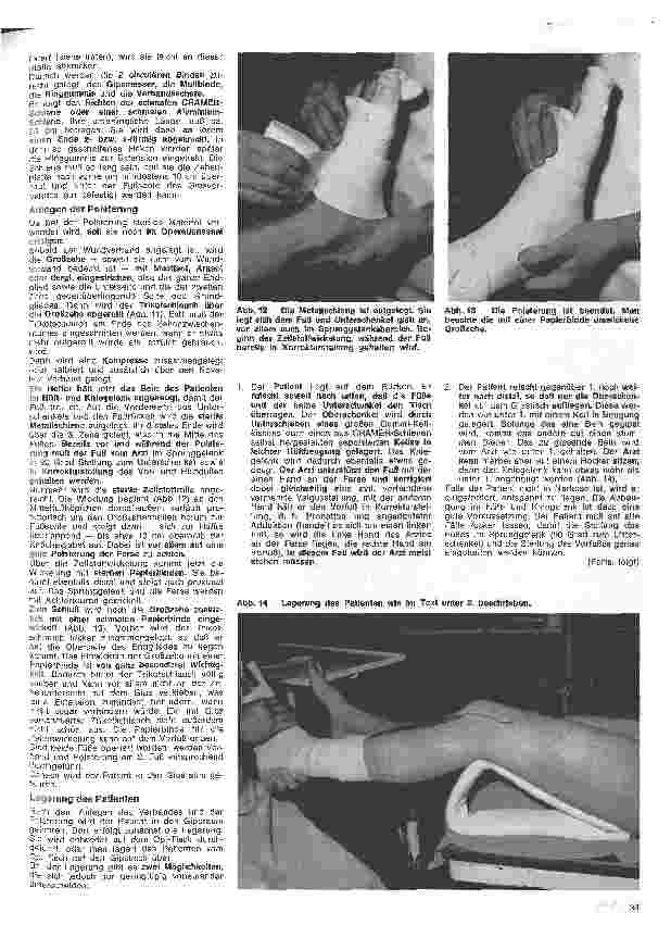 Vorschauseite 4: Grundlagen und Technik des Gipsverbandes 10. Folge: Fußgips nach OP eines Hallux valgus nach Brandes