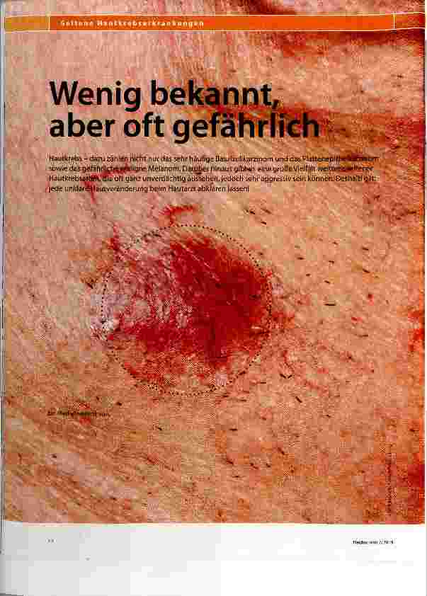 Vorschauseite 1: Wenig bekannt, aber oft gefährlich