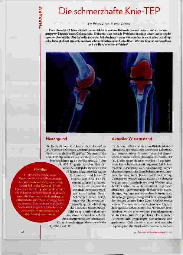Vorschauseite 1: Die schmerzhafte Knie-TEP