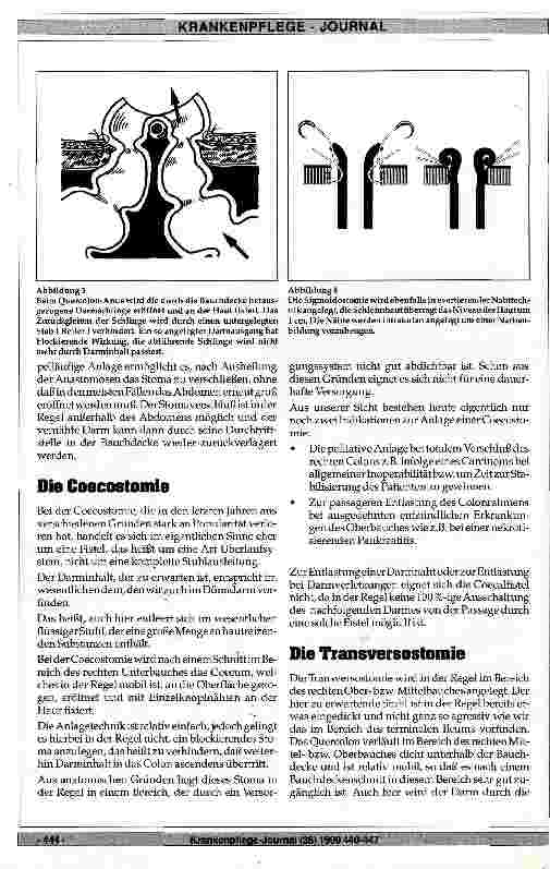 Vorschauseite 3: Die Arten der künstlichen Stuhlableitung