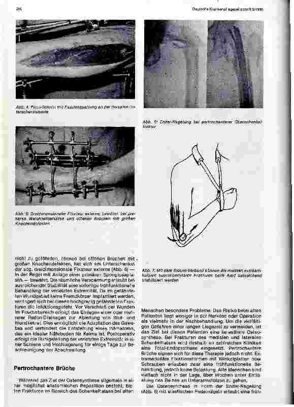 Vorschauseite 3: Fortschritte in der operativen und konservativen Knochenbruchbehandlung