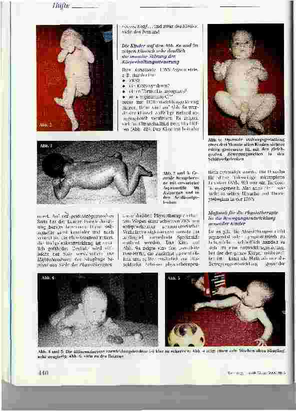 Vorschauseite 3: Die physiotherapeutische Behandlung der dysplastischen Hüfte