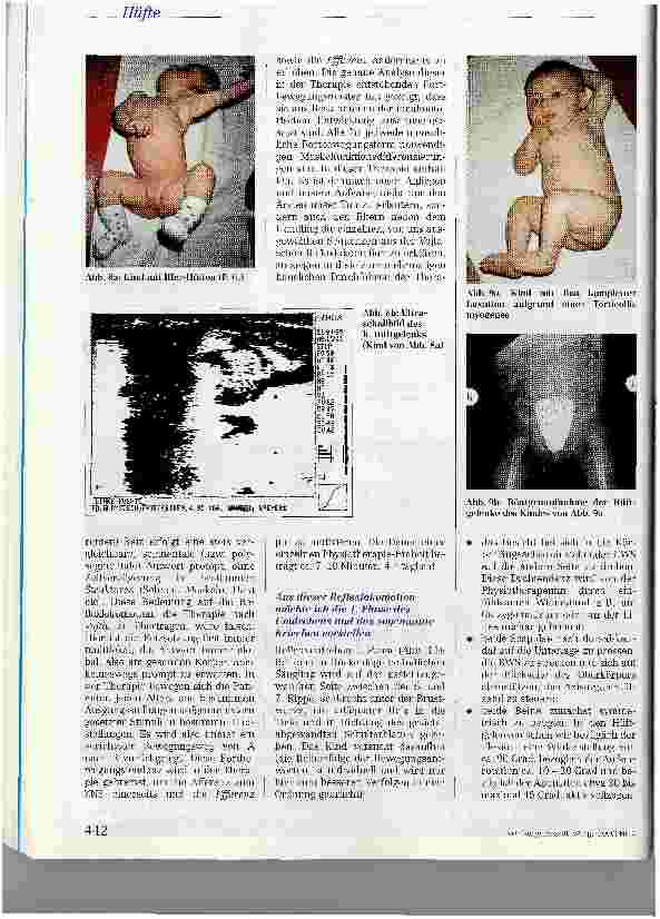 Vorschauseite 5: Die physiotherapeutische Behandlung der dysplastischen Hüfte