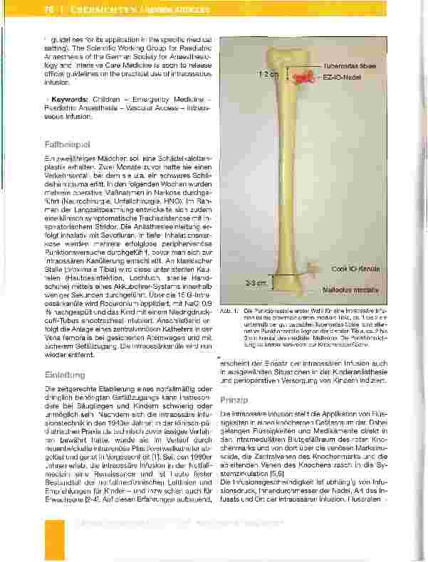 Vorschauseite 2: Die intraossare Infusion in der KindernotfaHmedizin und Kinderanästhesie
