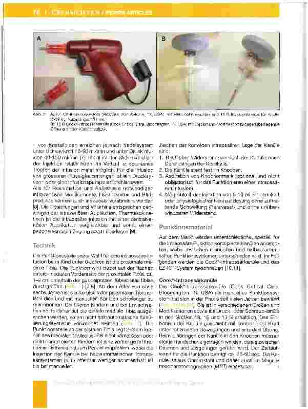 Vorschauseite 3: Die intraossare Infusion in der KindernotfaHmedizin und Kinderanästhesie