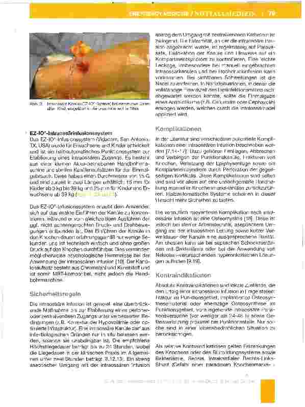 Vorschauseite 4: Die intraossare Infusion in der KindernotfaHmedizin und Kinderanästhesie