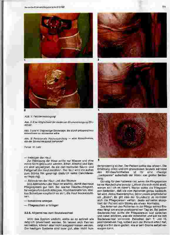 Vorschauseite 4: Enterostomatherapie