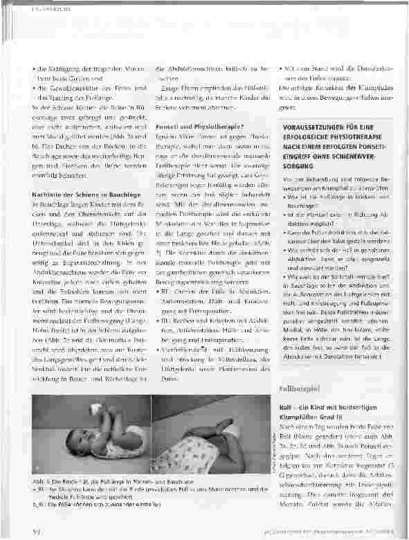 Vorschauseite 3: Kombinierte Klumpfußbehandlung