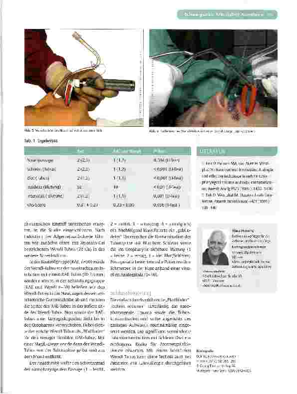 Vorschauseite 3: Nasotracheale Intubation in der Mund-, Kiefer-und Gesichtschirurgie