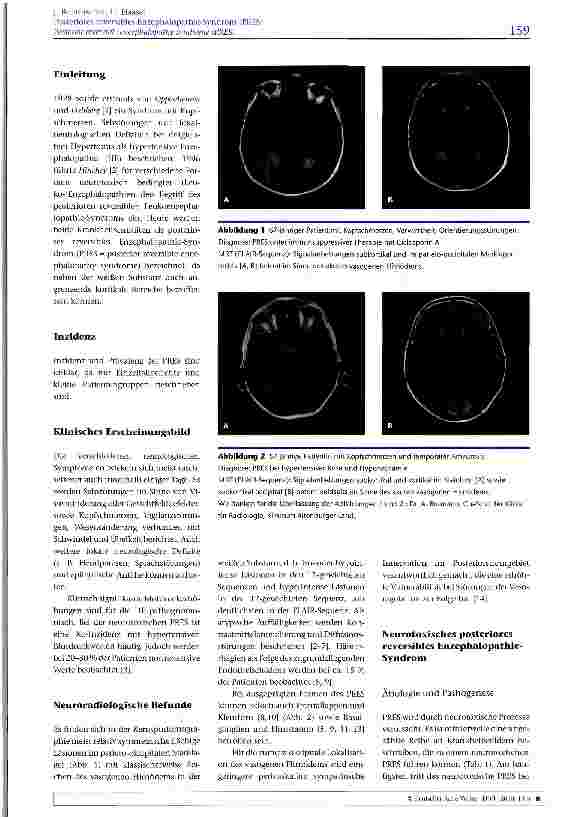 Vorschauseite 2: Posteriores reversibles Enzephalopathie-Syndrom (PRES)