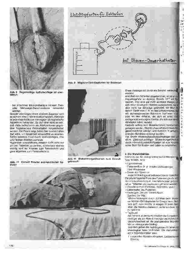 Vorschauseite 4: Pflegerische Praktiken aus der Sicht der Hygiene Aus der Chirurgischen Universitätsklinik München