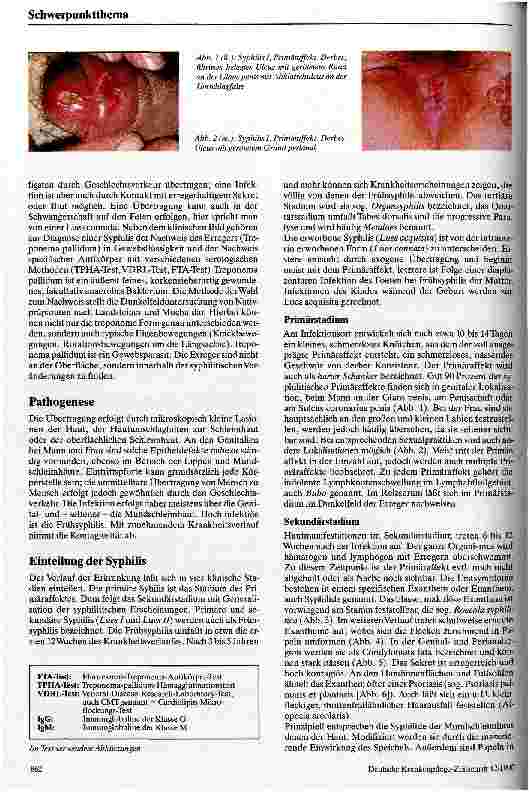 Vorschauseite 2: Klinik und Therapie der Syphilis