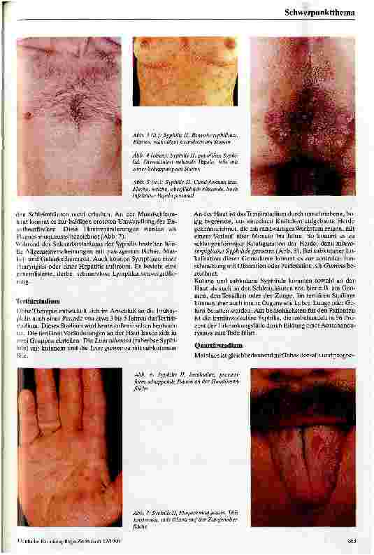 Vorschauseite 3: Klinik und Therapie der Syphilis