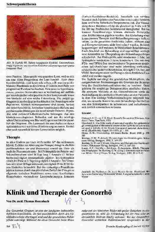 Vorschauseite 4: Klinik und Therapie der Syphilis
