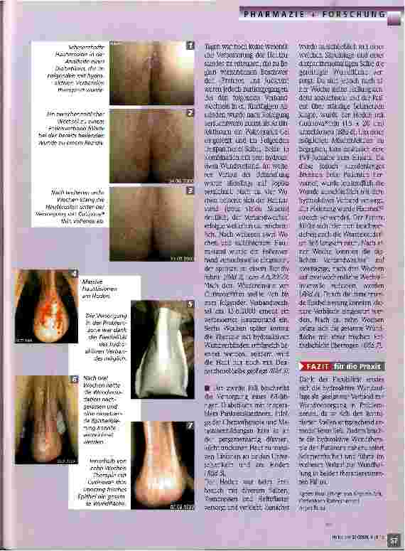 Vorschauseite 2: Hautläsionen gezielt therapiert
