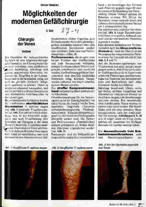 Vorschauseite 1: Möglichkeiten der modernen Gefäßchirurgie