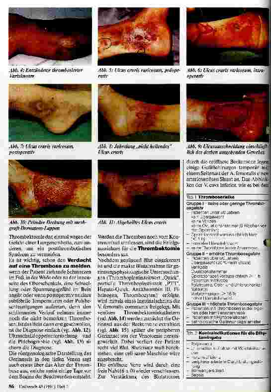Vorschauseite 2: Möglichkeiten der modernen Gefäßchirurgie