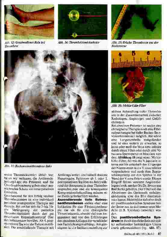 Vorschauseite 3: Möglichkeiten der modernen Gefäßchirurgie