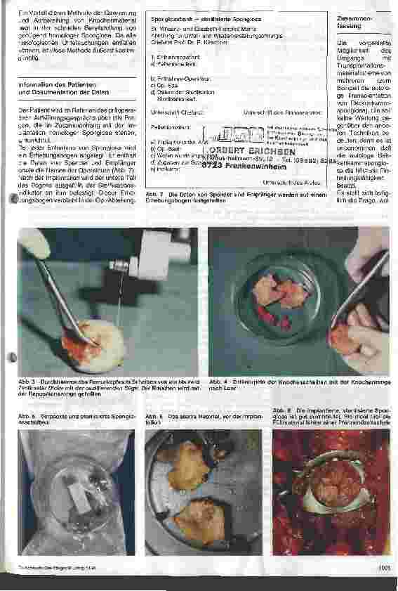 Vorschauseite 2: Gewinnung, Aufbereitung und Lagerung von Spongiosa zur Implantation
