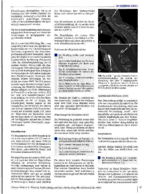 Vorschauseite 2: Planung, Vorbereitung und Kontrolle bei Eingriffen im Bereich der HWS