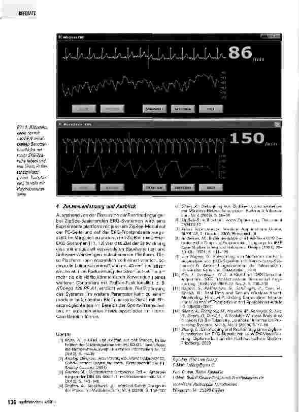 Vorschauseite 4: Experimentalplattform für ein EKG-System mit ZigBee und LabVIEW