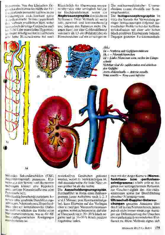 Vorschauseite 2: Vorkommen, Diagnostik, Klinik und Therapie der renovaskulären Hypertonie