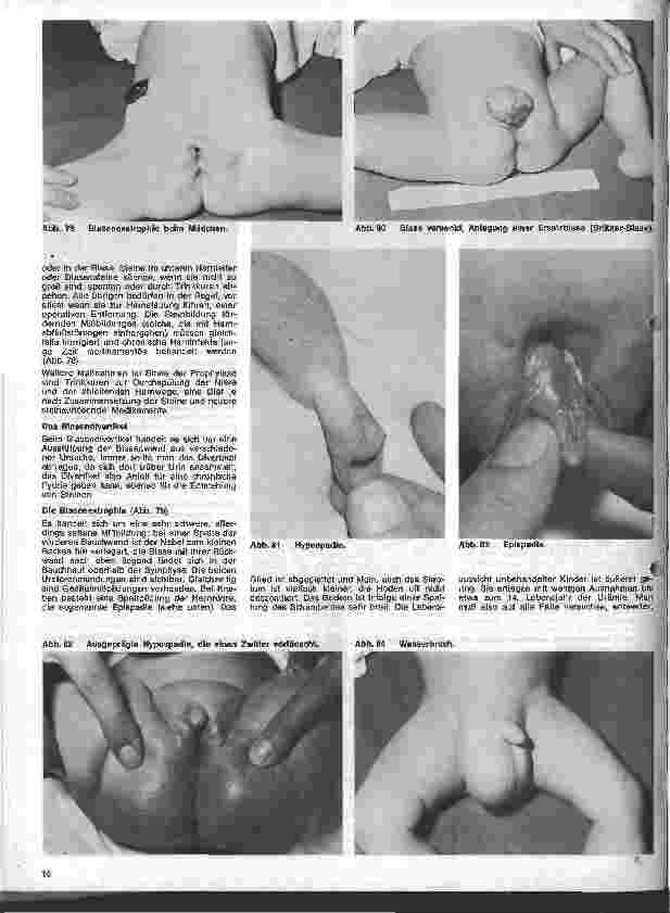 Vorschauseite 5: Kinderchirurgie 6. Folge: II. Spezielle chirurgische Erkrankungen des Kindesalters