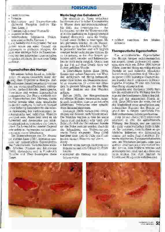 Vorschauseite 2: Honig auf die Wunde - Die Wiederentdeckung eines Naturheilmittels