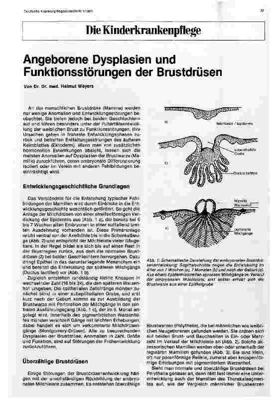 Vorschauseite 1: Angeborene Dysplasien und Funktionsstörungen der Brustdrüsen