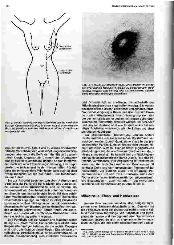 Vorschauseite 2: Angeborene Dysplasien und Funktionsstörungen der Brustdrüsen