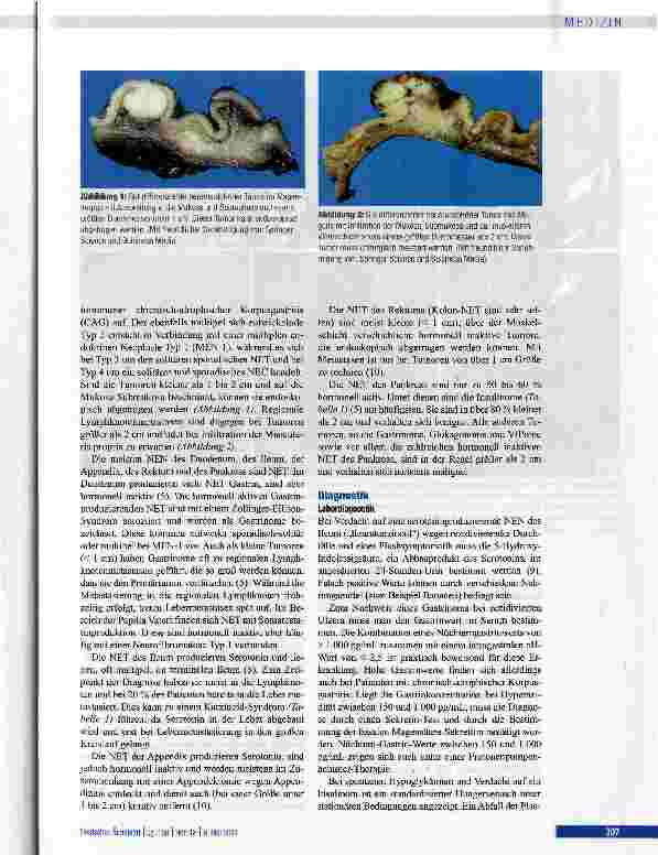 Vorschauseite 3: Gastroenteropankreatische neuroendokrine Neoplasien