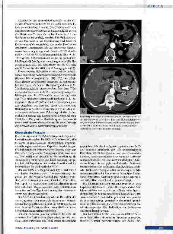 Vorschauseite 5: Gastroenteropankreatische neuroendokrine Neoplasien