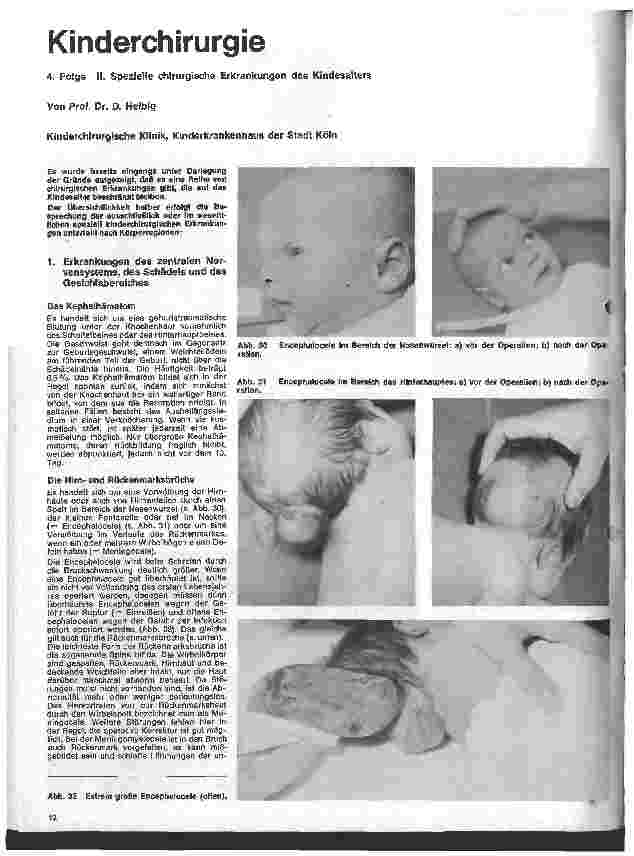 Vorschauseite 1: Kinderchirurgie 4. Folge: II. Spezielle chirurgische Erkrankungen des Kindesalters