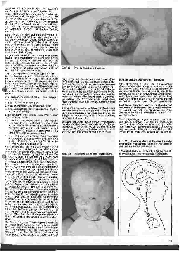 Vorschauseite 2: Kinderchirurgie 4. Folge: II. Spezielle chirurgische Erkrankungen des Kindesalters