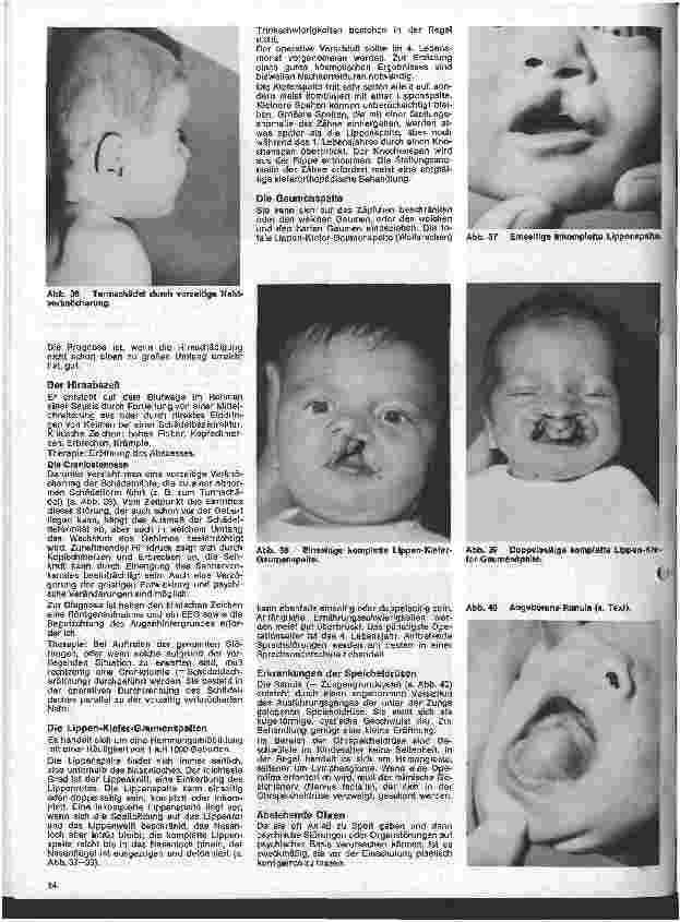 Vorschauseite 3: Kinderchirurgie 4. Folge: II. Spezielle chirurgische Erkrankungen des Kindesalters