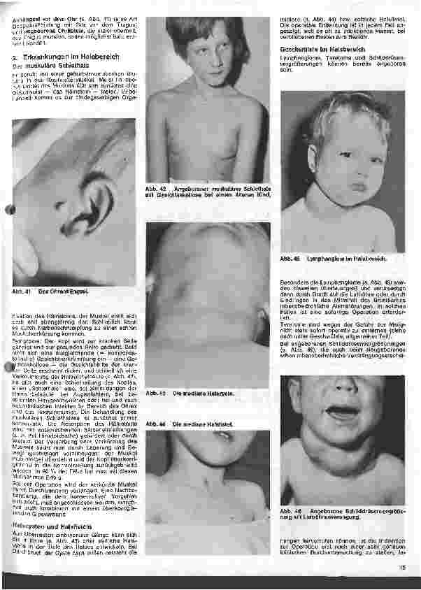 Vorschauseite 4: Kinderchirurgie 4. Folge: II. Spezielle chirurgische Erkrankungen des Kindesalters