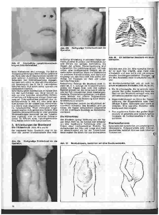 Vorschauseite 5: Kinderchirurgie 4. Folge: II. Spezielle chirurgische Erkrankungen des Kindesalters