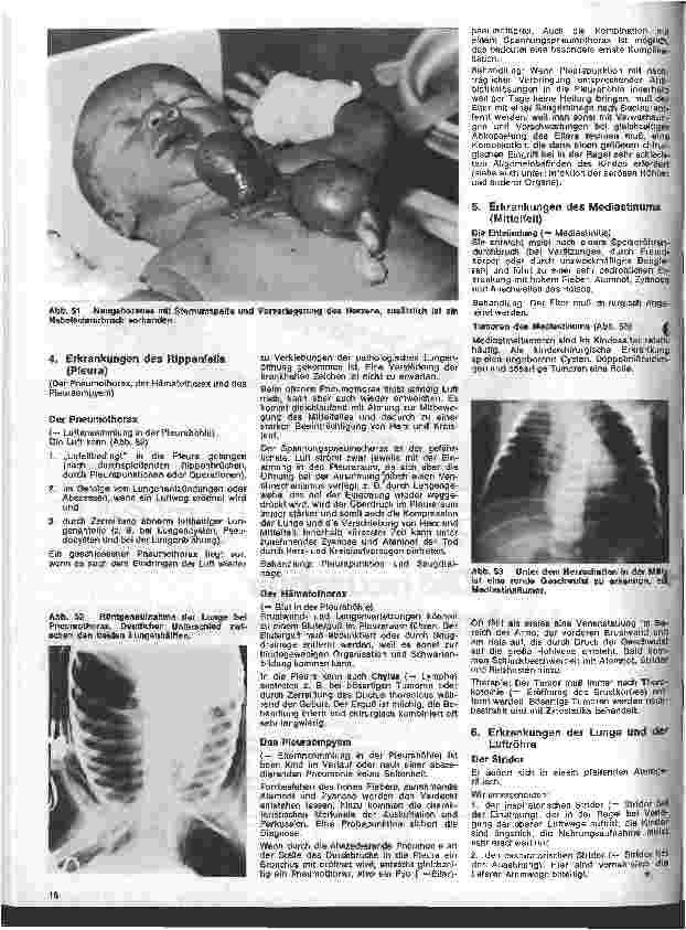 Vorschauseite 6: Kinderchirurgie 4. Folge: II. Spezielle chirurgische Erkrankungen des Kindesalters