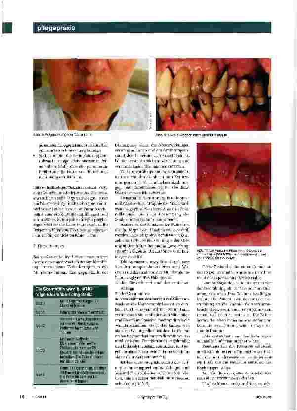 Vorschauseite 3: Prävention der Stomatitis