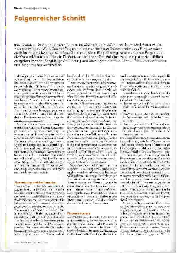 Vorschauseite 1: Folgenreicher Schnitt