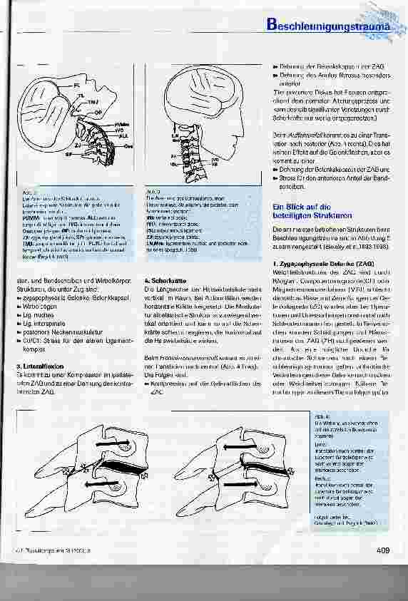 Vorschauseite 4: Beschleunigungstrauma - Aspekte aus Patho-mechanik und Pathophysiologie als Grundlage für die Behandlung nach der Funktionellen Bewegungslehre Klein-Vogelbach * (Teil I)