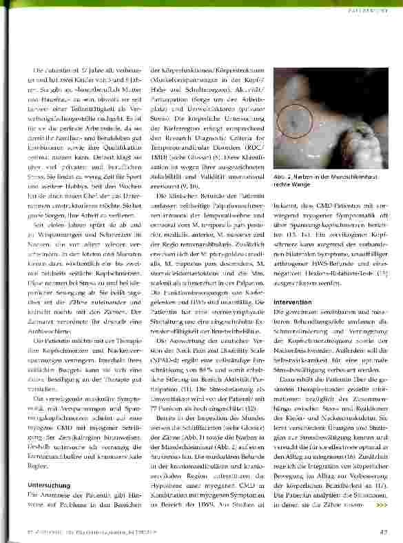 Vorschauseite 2: Physiotherapie bei CMD