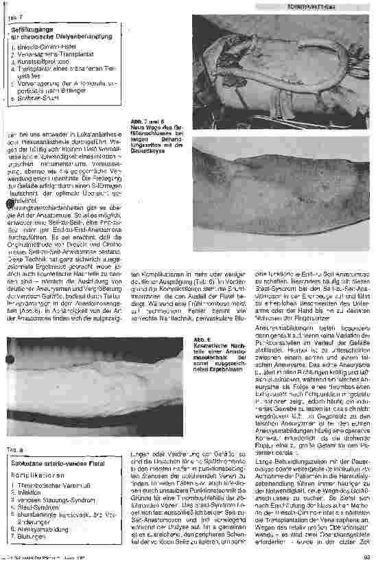Vorschauseite 3: Gefäßzugänge bei Dialysepatienten
