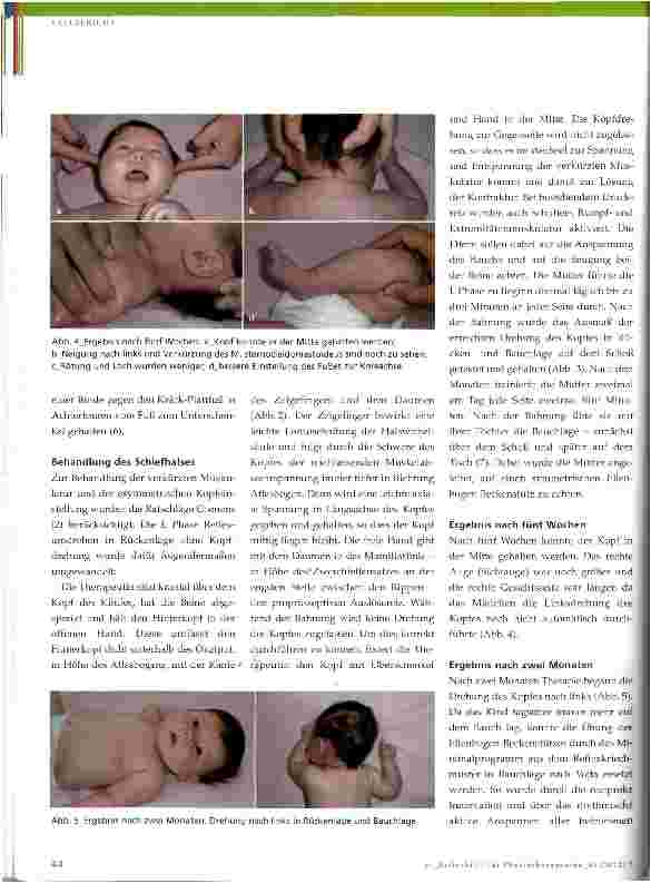 Vorschauseite 3: Physiotherapeutische Behandlung bei Plagiozephalus