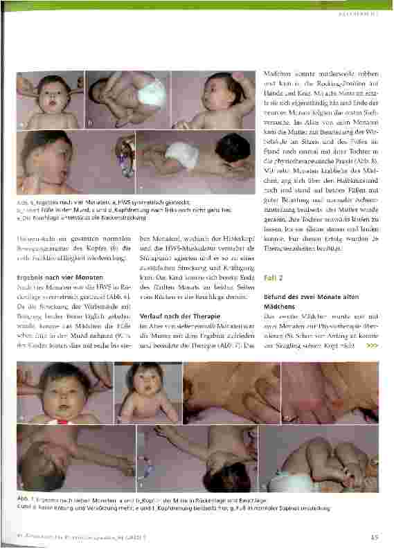 Vorschauseite 4: Physiotherapeutische Behandlung bei Plagiozephalus